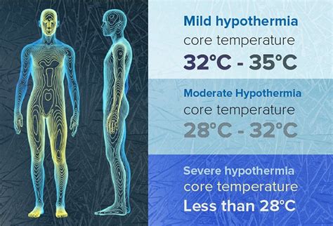 Hypothermia .